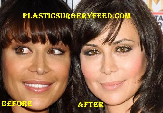 Catherine Bell Plastic Surgery Plastic Surgery Feed