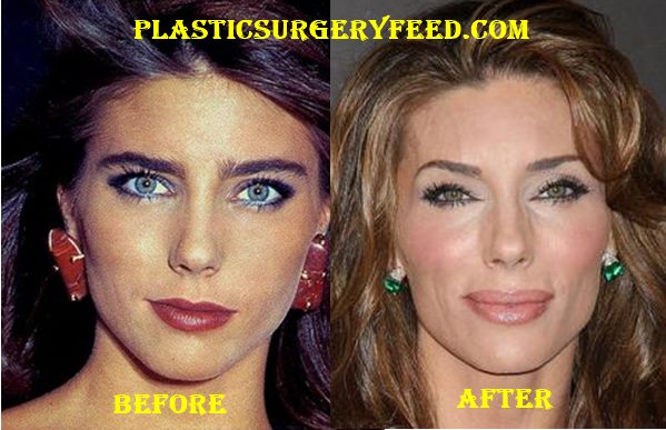 Jenny Mccarthy Plastic Surgery