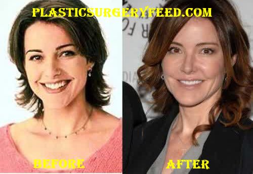 Christa Miller Cheeks Filler