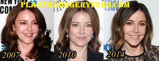 Christa Miller Nose Job Rhinoplasty