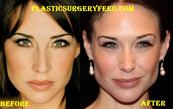 Claire Forlani Plastic Surgery, Hearing an actress's gossip…