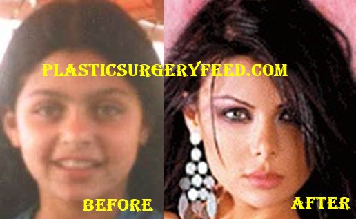 Haifa Wehbe Nose Job Rhinoplasty