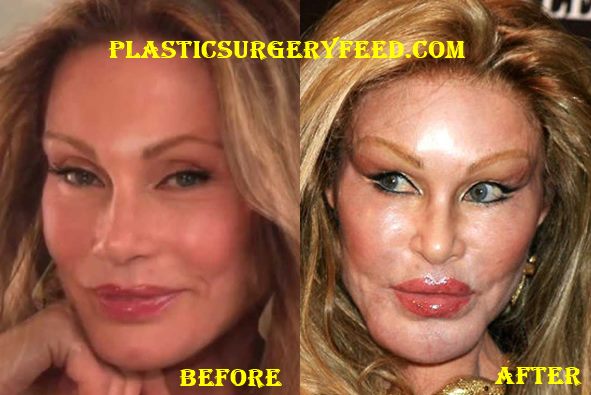 Jocelyn Wildenstein Before Plastic Surgery