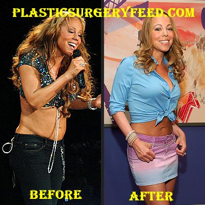 Mariah Carey Liposuction