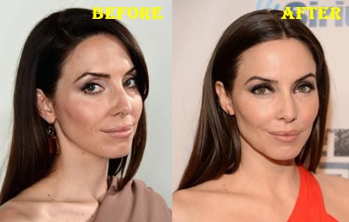 Whitney Cummings Botox Before After