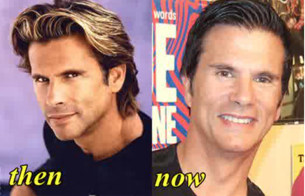 Lorenzo Lamas Botox