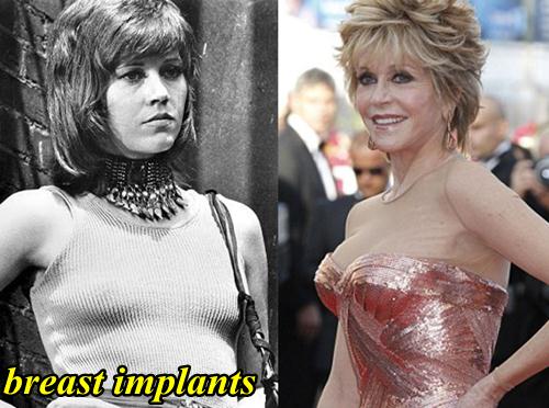 Jane Fonda Breast Implants