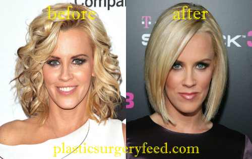 Jenny McCarthy Nose Job