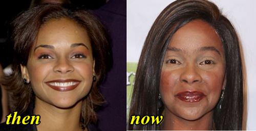 Lark Voorhies Botox and Facelift