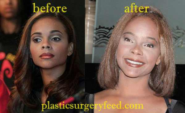 Lark Voorhies Eyelid Surgery