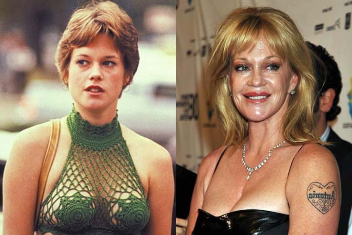 Melanie Griffith Breast Implant