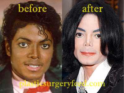 Michael Jackson Facial Reconstruction