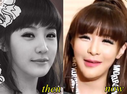 Park Bom Chin Enhancement