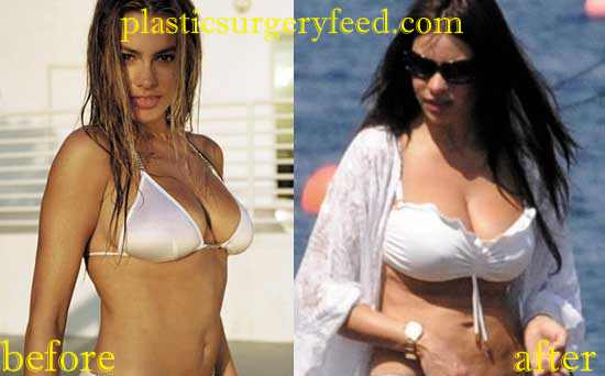 Sofia Vergara Tummy Tuck