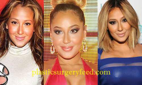 Adrienne Bailon Blepharoplasty