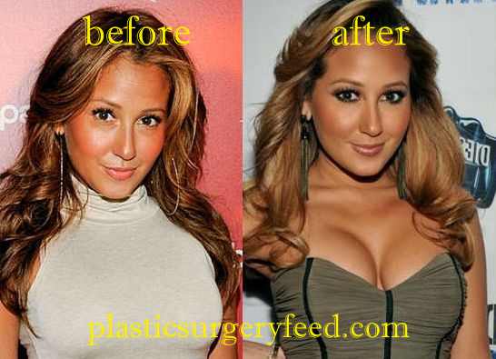 Adrienne Bailon Breast Implant