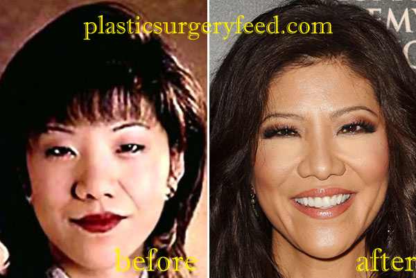 Julie Chen Nose JOb