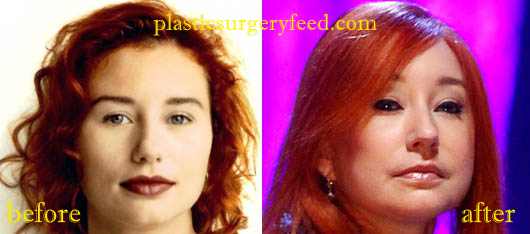 Tori Amos Nose JOb