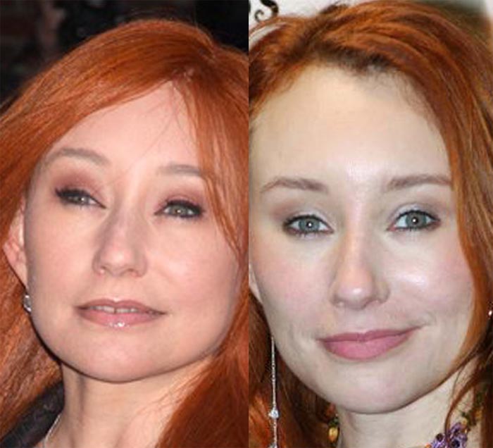 Tori Amos Plastic Surgery