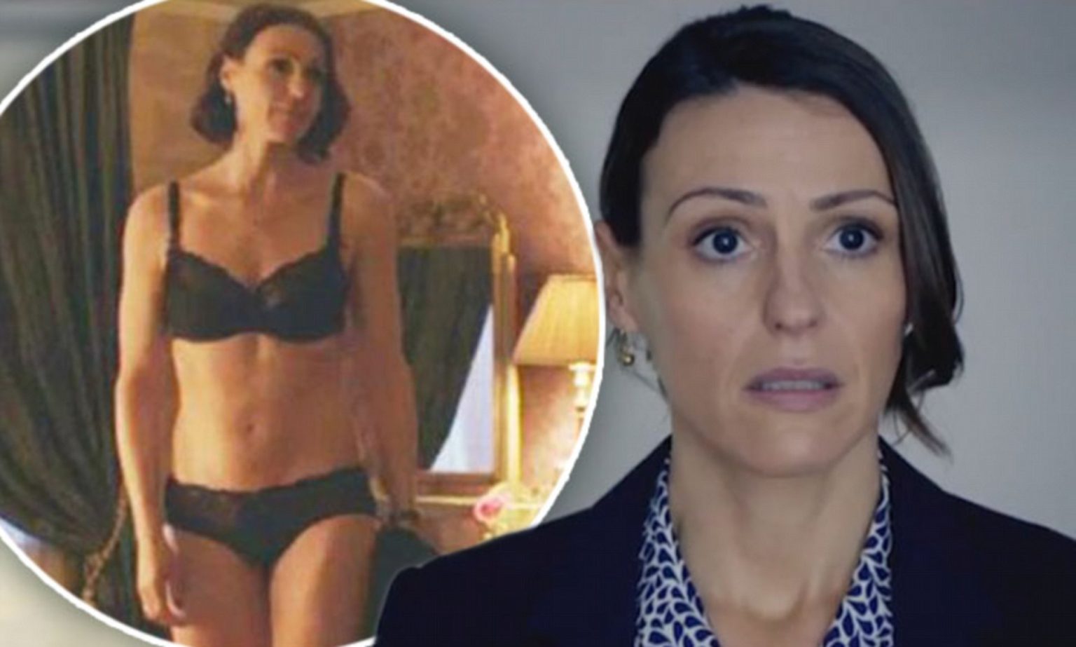 Suranne Jones Boob Job Before And After Images Plastic Surgery Feed