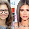 zendaya underwent plastic surgery