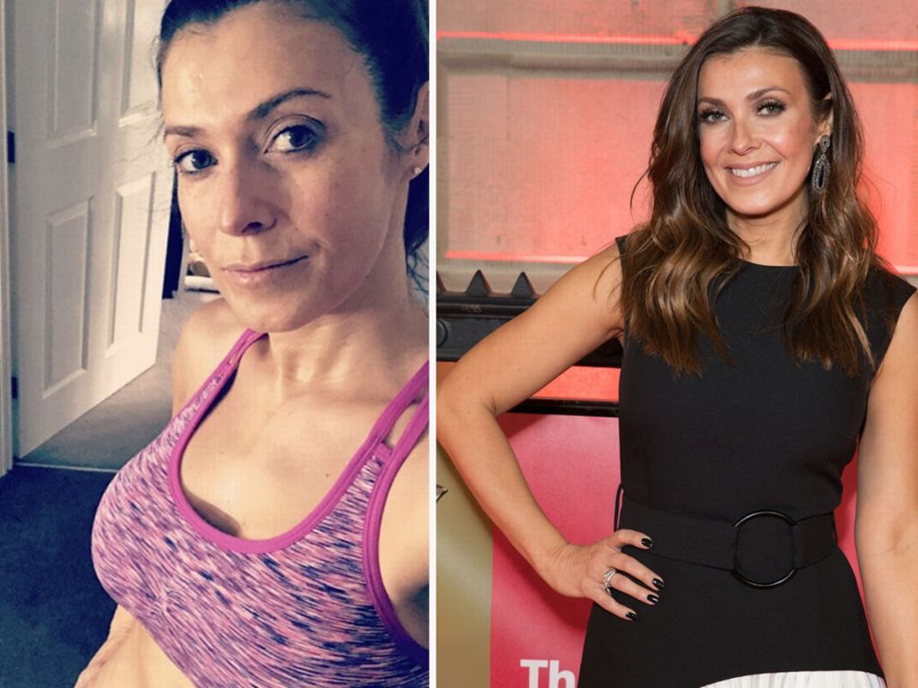 Kym Marsh Plastic Surgery and Body Measurements