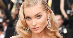 Elsa Hosk Plastic Surgery