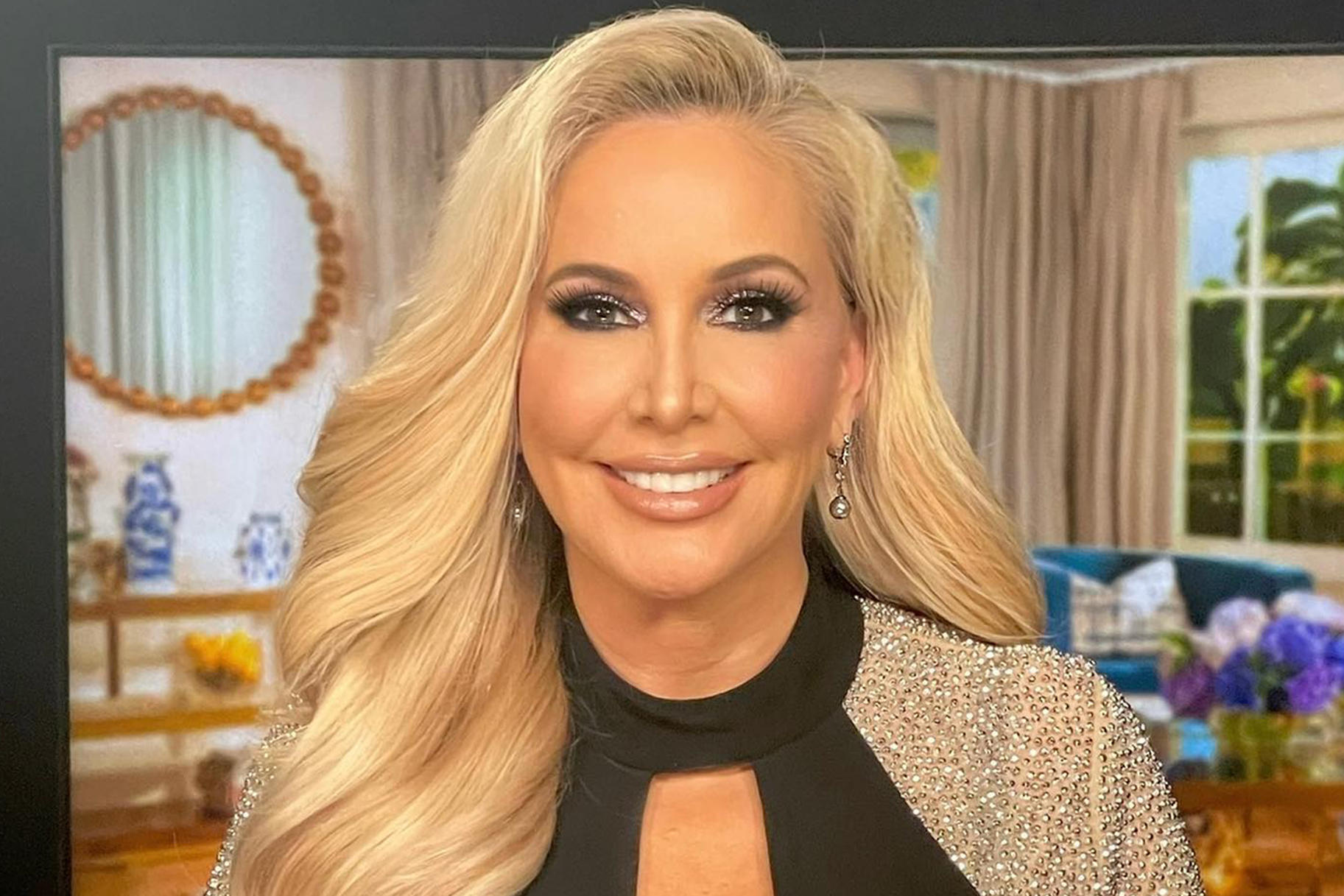 Shannon Beador S Fillers Before And After Images Plastic Surgery Feed