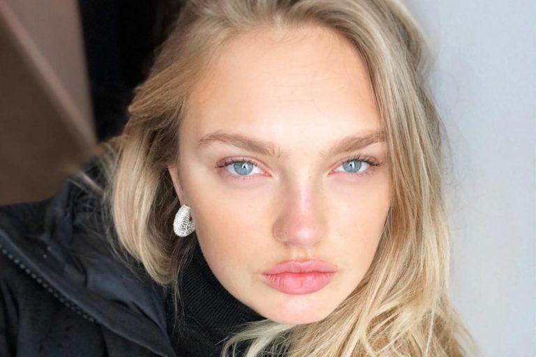 Did Romee Strijd Undergo Plastic Surgery Facts And Rumors Plastic Surgery Feed 