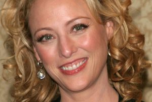 Virginia Madsen Cosmetic Surgery