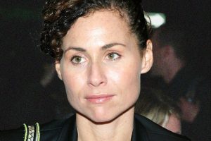 Minnie Driver Plastic Surgery