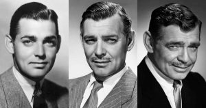 Clark Gable Plastic Surgery Procedures