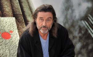 Ian McShane Plastic Surgery Procedures