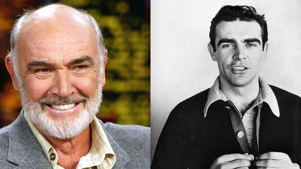 Sean Connery Plastic Surgery Procedures