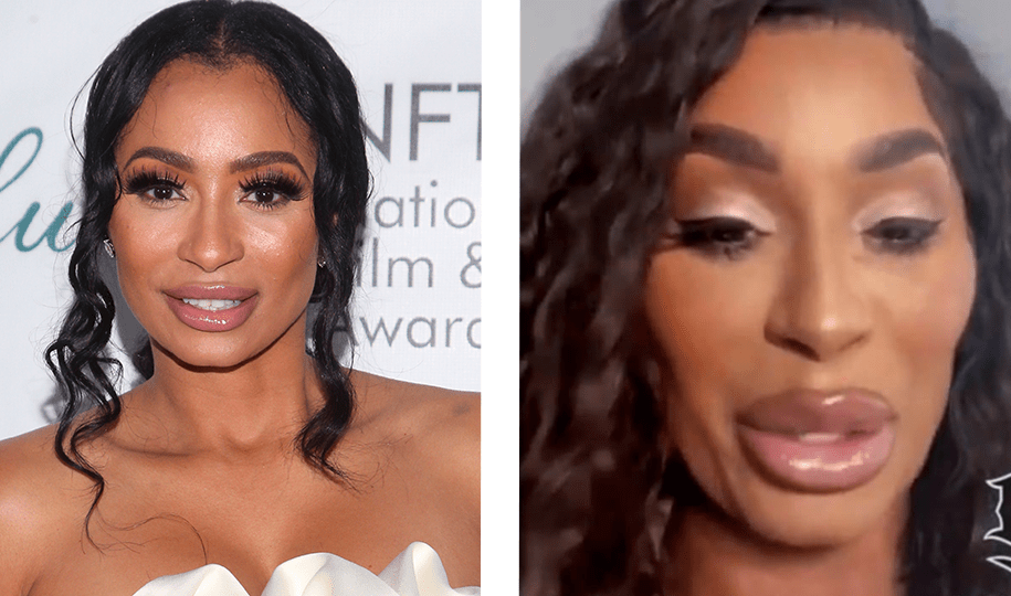 Karlie Redd Plastic Surgery