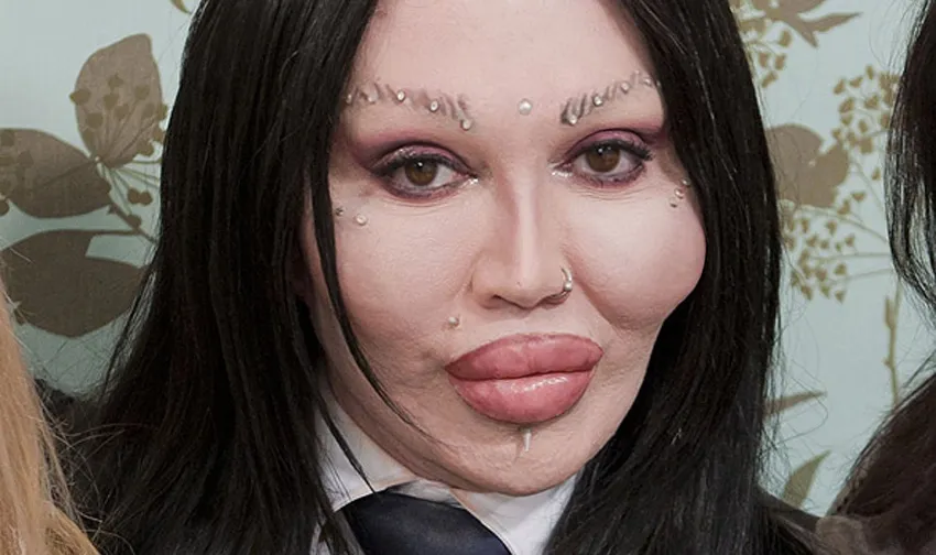 Pete Burns